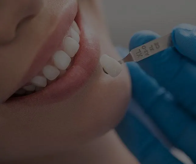 Tooth Repair With Dental Fillings - Hamilton Precise Dental